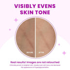 Acidified Body Wash - 24 Hour Odor Control - Removes Odor Better than Soap - Moisturizing Formula - Formulated Without SLS or Parabens - OB/GYN Developed - 8.5 ounce (Unscented)